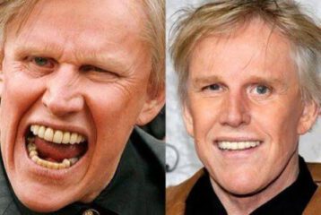 actors have fake teeth
